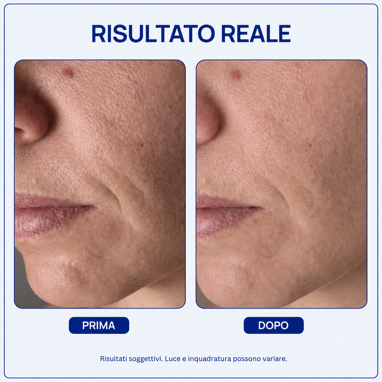 LUNÉA Skin Reset